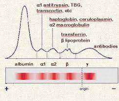 الکتروفورز پروتئین سرم(SPEP) , تعریف: SPEP , پروتئین های اصلی خون, آلبومین و گلوبولین ها, اندازه گیری,  (Dehydration) , α- گلوبولین ها , γ گلوبولین ها , اجزای سرم پروتئین, اینترزون آلبومین- آلفا-1 , ناحیه آلفا-1 , اینترزون آلفا-1 با آلفا -2 , ناحیه آلفا-2 , اینترزون آلفا-2 و بتا , ناحیه بتا , اینترزون بتا-گاما , ناحیه گاما , مقادیر طبیعی , یافته های غیر طبیعی , پروتئین تام , بیماری کبدو کم آبی , تفسیر آزمایش , الکتروفورز پروتئین سرم , نمودار الکتروفورز پروتئین , افزایش گاماگلوبولین , الکتروفورز پروتئین های سرمی , الکتروفورز پروتئین+ppt , روش الکتروفورز پروتئین , تفسیر نمودار الکتروفورز , بتا گلوبولین